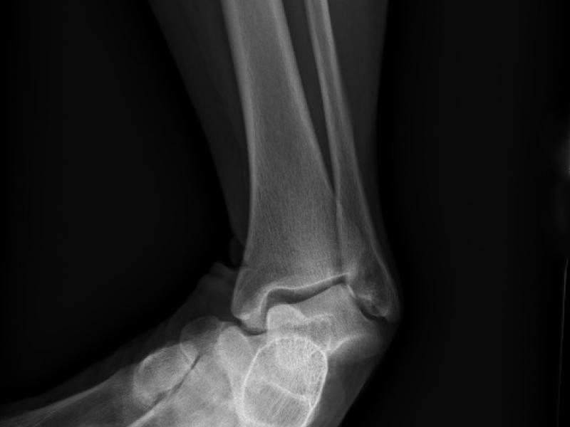 What's the diagnosis? By Dr. F. Jon Skilton