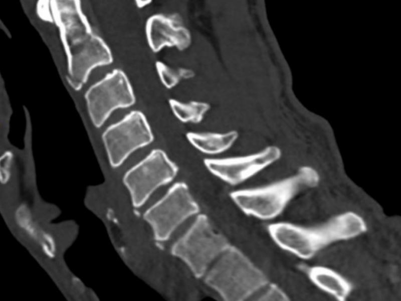 What's the Diagnosis? By Dr. Loran Hatch