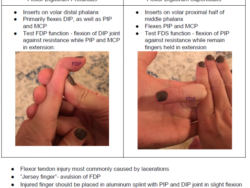 Back to Basics: Digit Flexor Tendons