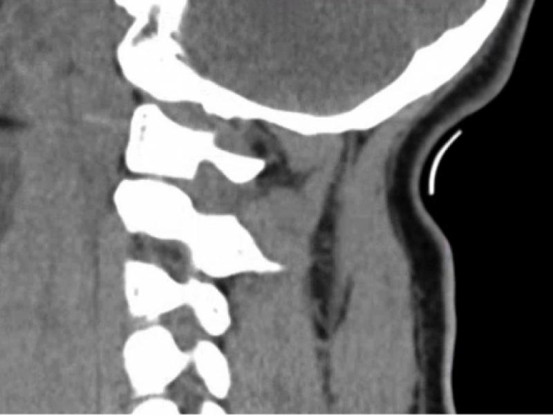 What's the Diagnosis? By Dr. Michael Tom