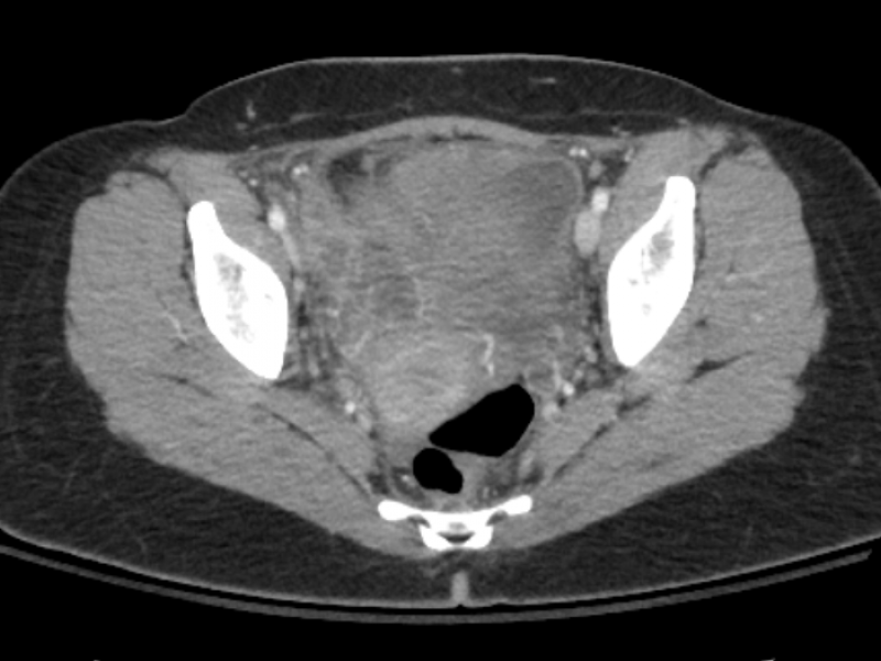 What's the Diagnosis?  By Dr. Sarab Sodhi