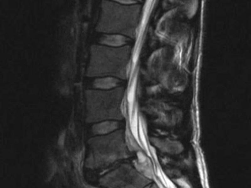 What's the Diagnosis? By Dr. Loran Hatch