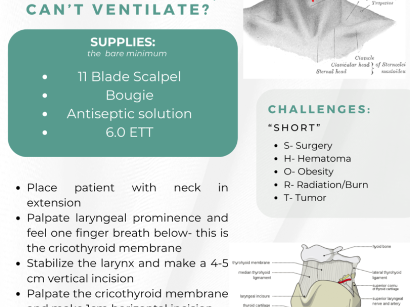 "Knife, Finger, Bougie" Cricothyrotomy Made Easy