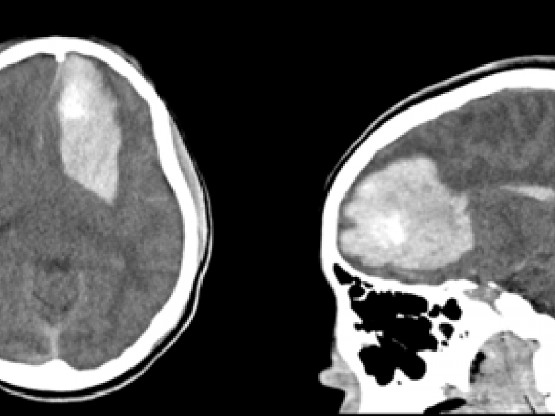 What's the Diagnosis? By Dr. Eric Chavis