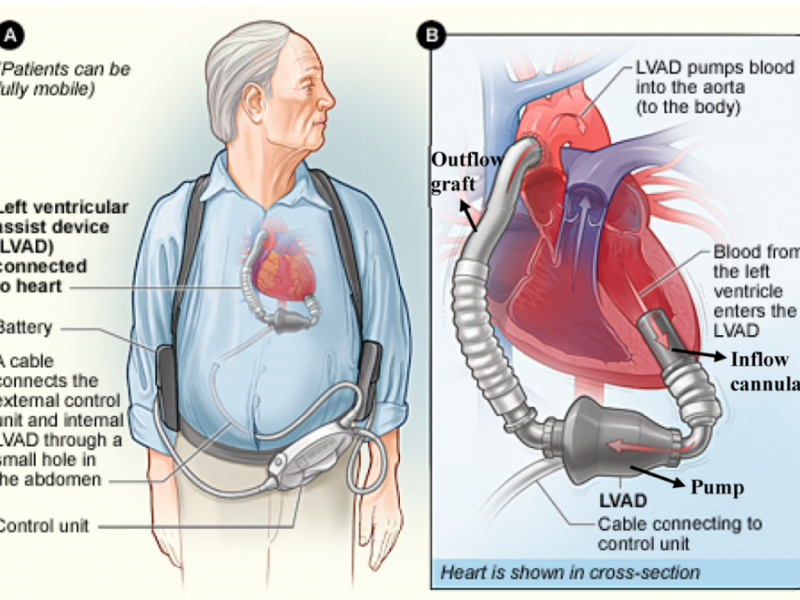 Board Review: Cardiology