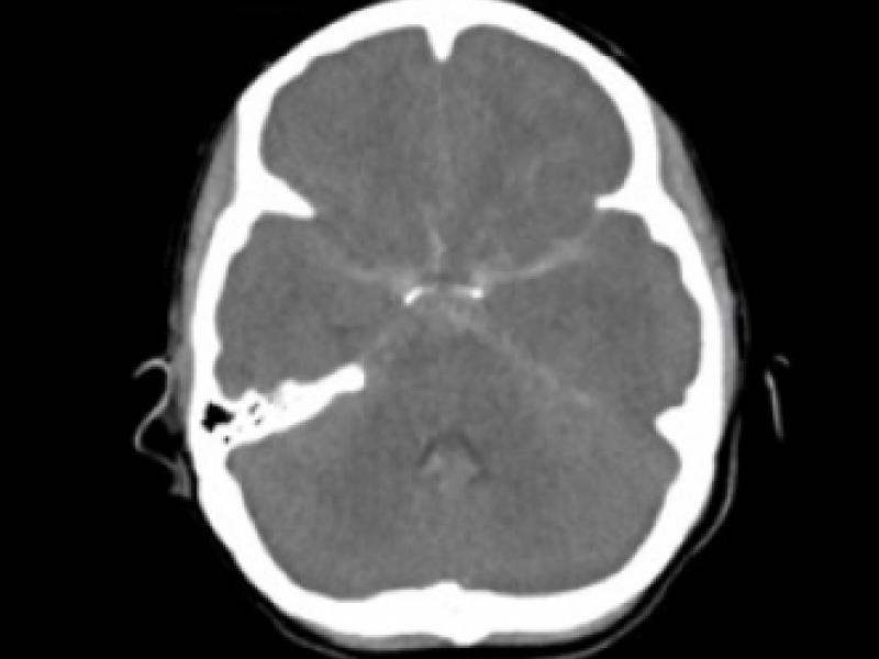 What's the diagnosis?  By Dr. Michael Tom