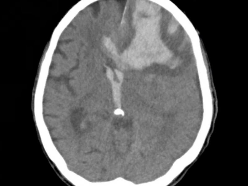 What's the diagnosis?  By Dr. Michael Tom