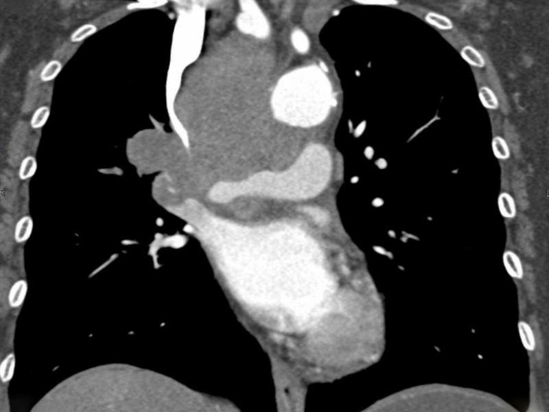 What's the Diagnosis (Critical Care Edition) By. Dr. Kim Chavez