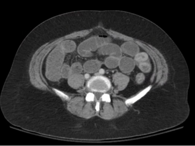 What's the Diagnosis?  By Dr. Loran Hatch