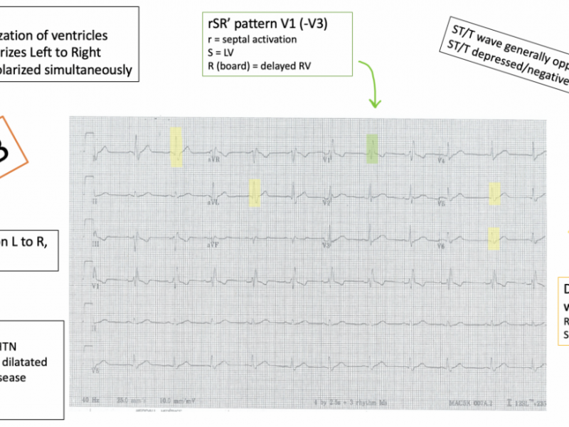 #EMConf: ECG review