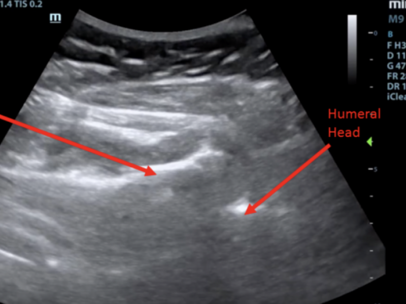 #EMConf: Blocks