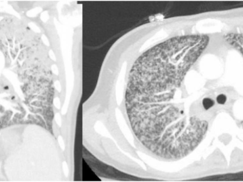 What's the diagnosis?  By Dr. Abby Renko