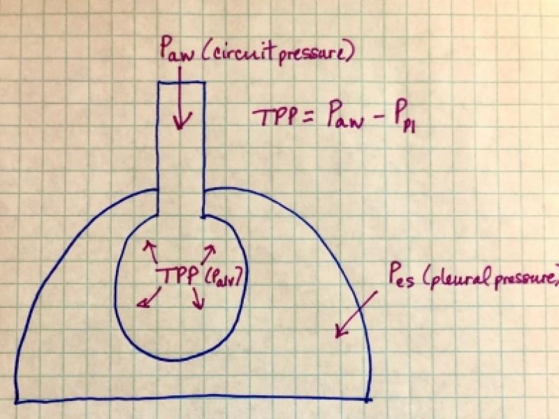 Preventing ventilator-induce lung injury (VILI): Optimizing PEEP titration in ARDS