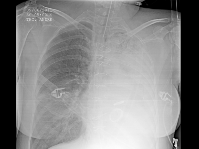 Board Review: Critical Care