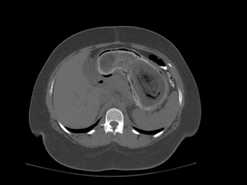 What's the diagnosis?  By Dr. Katie Selman