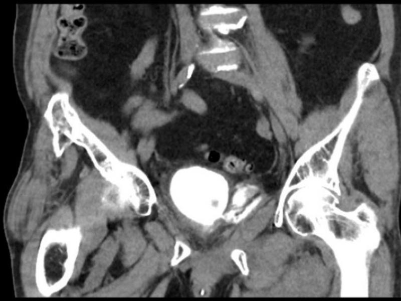 What's the diagnosis?  By Dr. Katie Selman