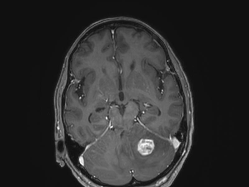 What's the diagnosis?  By Dr. Angela Ugorets