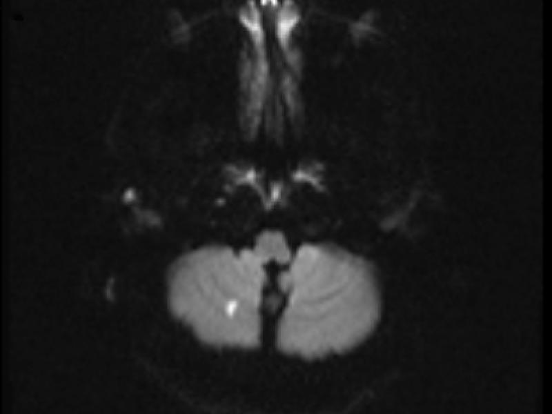 What's the diagnosis?  By Dr. Eric Chavis