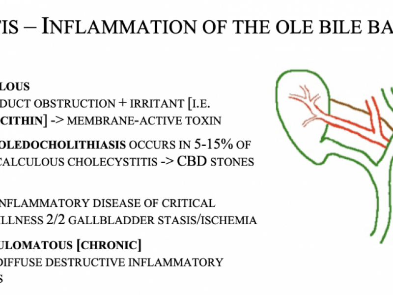 Back to Basics: Cholecystitis