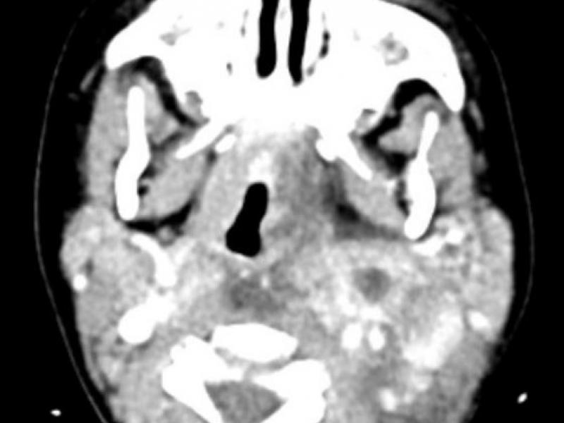 What's the Diagnosis? By Dr. Lesley Walinchus-Foster