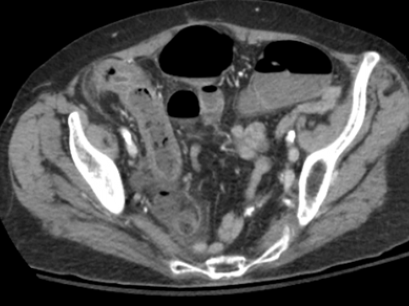 What's the Diagnosis? By Erica Schramm, MD