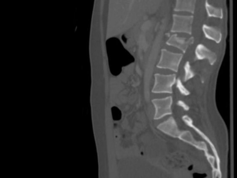 What's the Diagnosis? By Dr. Katie Selman