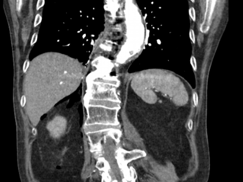 What's the Diagnosis? By Sarab Sodhi