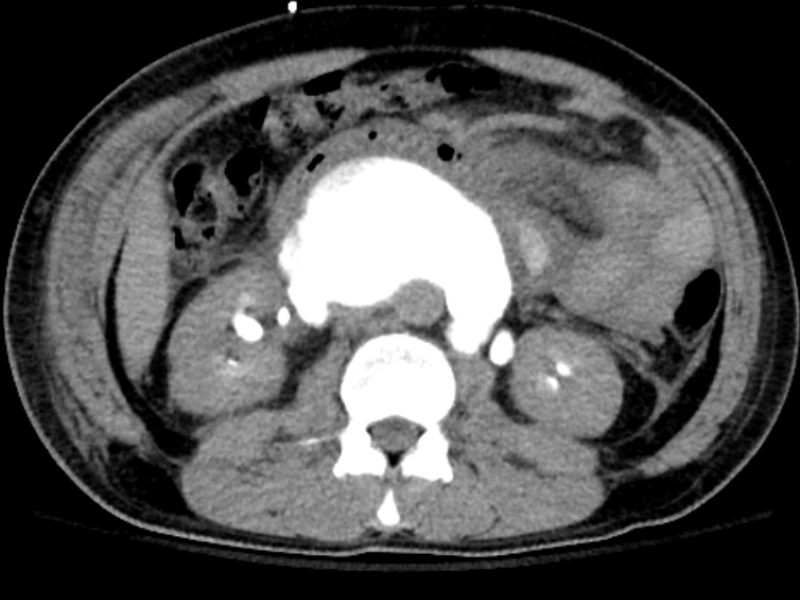 What's the Diagnosis? By Dr. Michael Tom