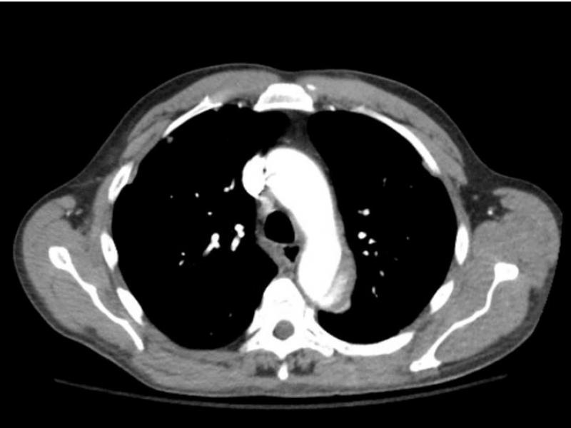 What's the Diagnosis? By Dr. Michael Tom