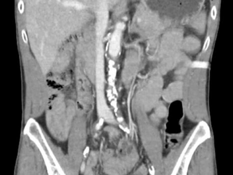 What's the Diagnosis? By Dr. Loran Hatch