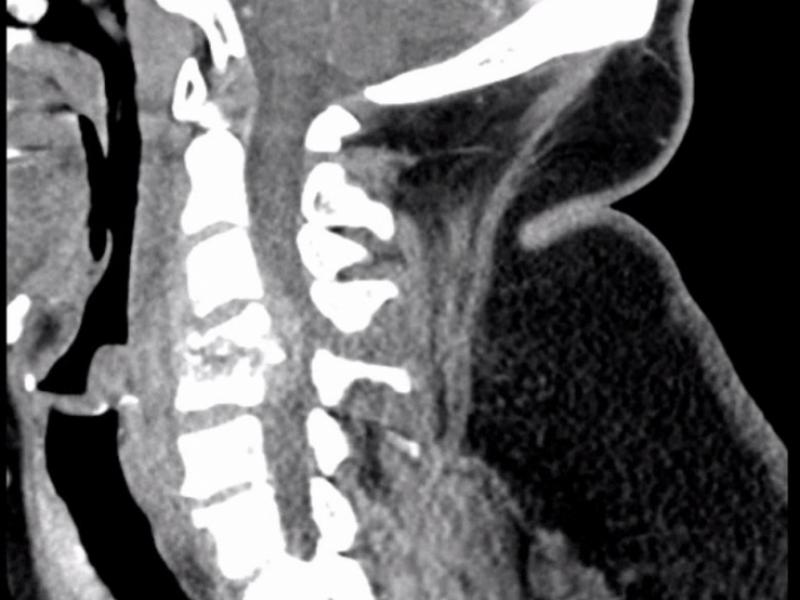 What's the diagnosis?  By Dr. Katie Selman