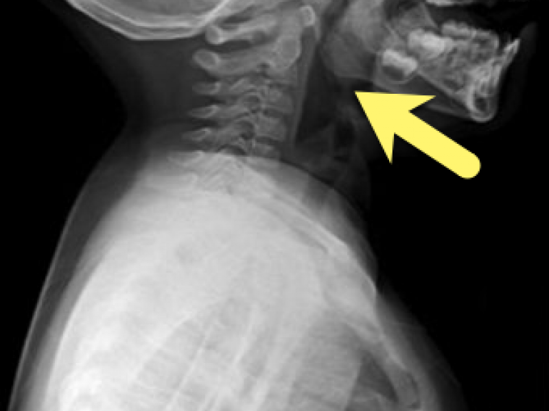 What's the Diagnosis? By Dr. Sarab Sodhi