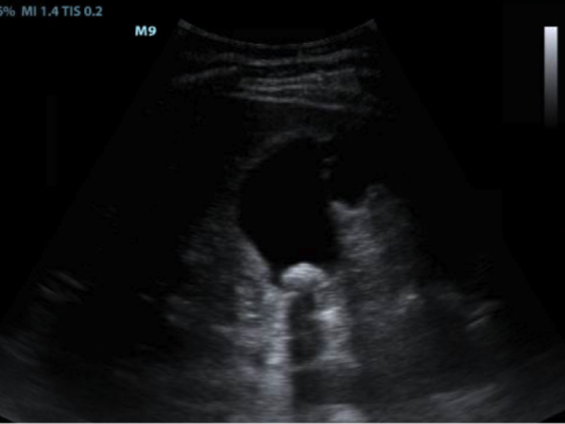 Imaging Case: Woman with Abdominal Pain