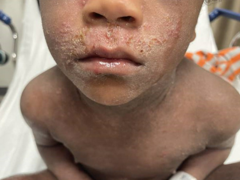 What's the Diagnosis? By Dr. Edward Guo