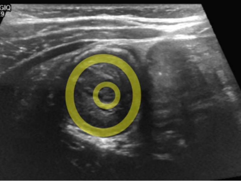 What's the Diagnosis? Case by Lauren Murphy