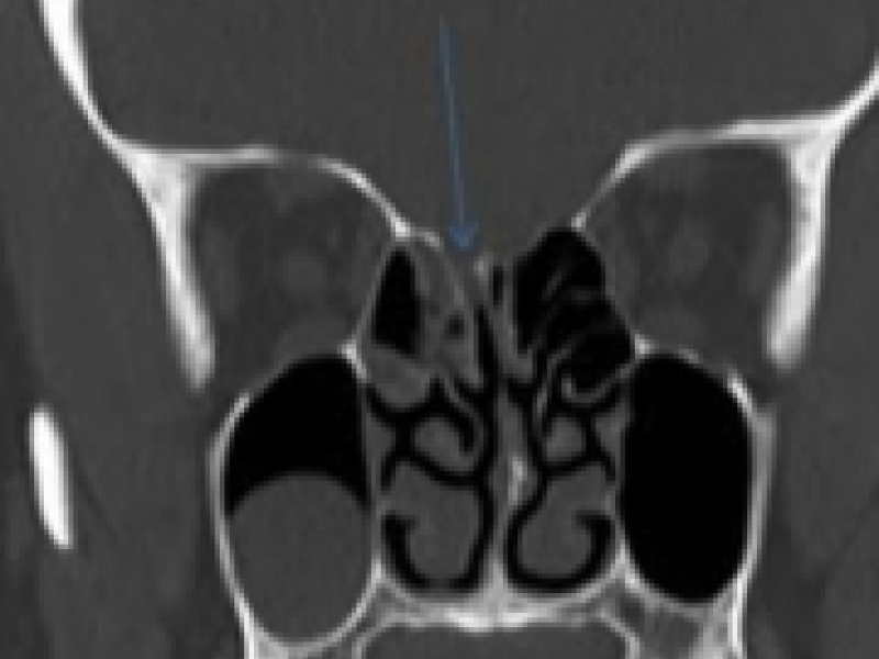 What's the Diagnosis? Critical Care Edition By Dr. Kim Chavez