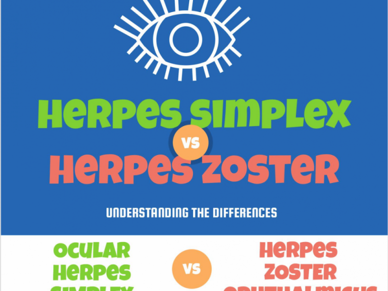 Back to Basics:  Ocular Herpes Simplex vs Herpes Zoster Ophthalmicus