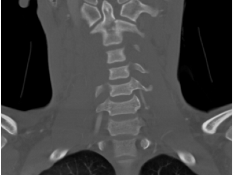 What's the Diagnosis? By Dr. Erica Schramm