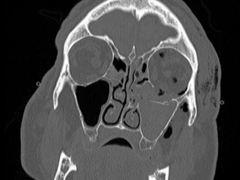 What's the Diagnosis? By Dr. Loran Hatch