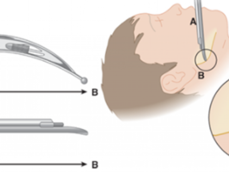 Back to Basics: Pediatric ETTs & Blades