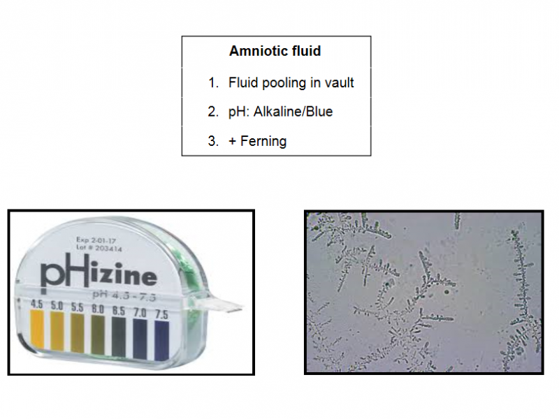 Back to Basics: Is that Amniotic Fluid?