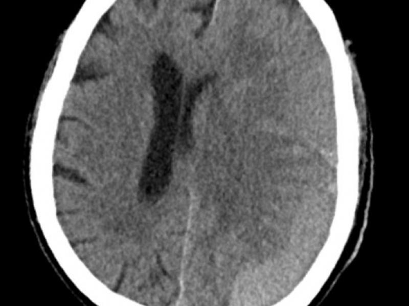 What's the Diagnosis? By Dr. Sarab Sodhi