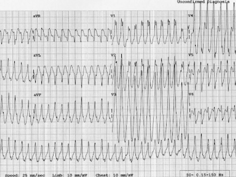 Board Review: Cardiology