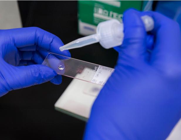 Gloved hands using a dropper to place liquid onto a microscope slide in a laboratory setting.