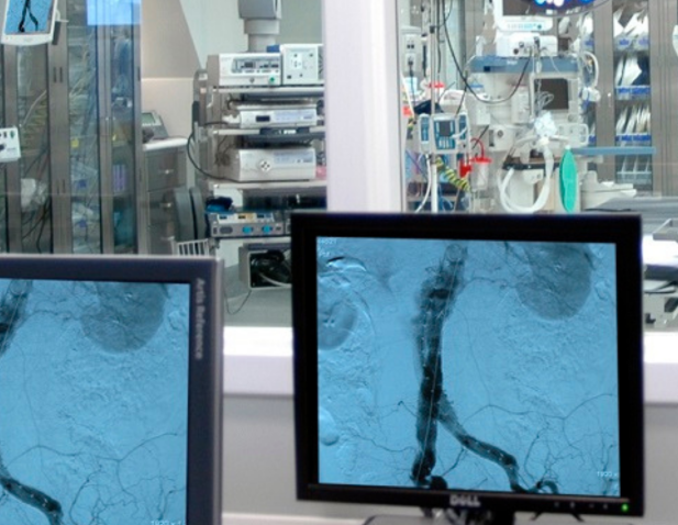 Vascular images on desktop screen in foreground with OR in background.